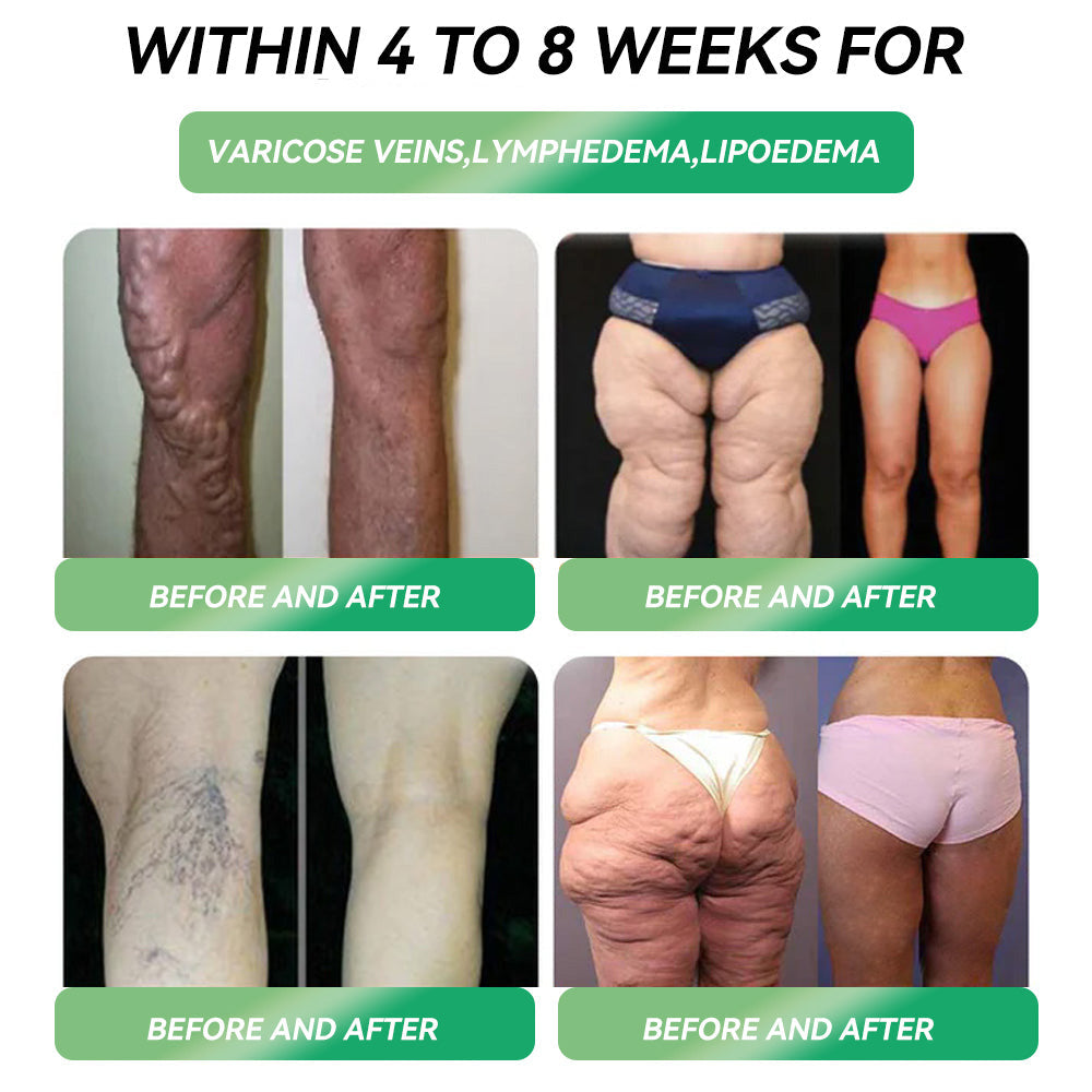 No Intense Workouts Required—WarmFamily®🇺🇸𝐺𝐿𝑃-𝟏  Lose Weight Fast with Less Effort. ⚡ Increase Metabolism
